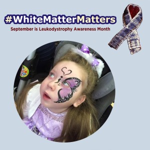 White-Matter-Matters-Lauren